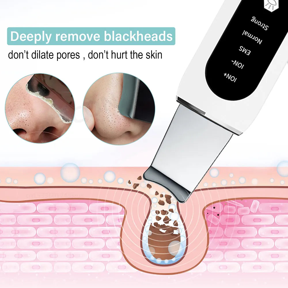 Ultrasonic Skin Scrubber Peeling Blackhead Remover Deep Face Cleaning